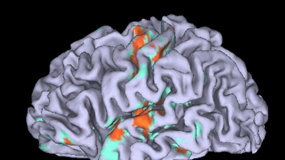Il cancro interrompe il ritmo naturale del cervello, causa insonnia e ansia