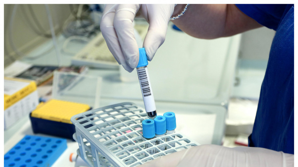 Schizofrenia, nel sangue le spie che indicano la risposta ai farmaci