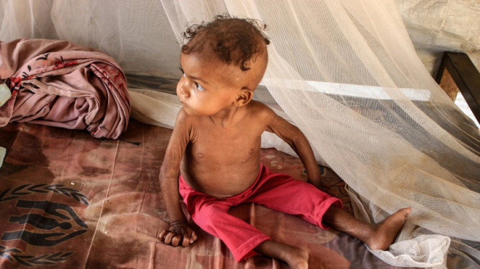 Con 3 a&ntilde;os y 4 kilos, una ni&ntilde;a al filo de la muerte en Yemen