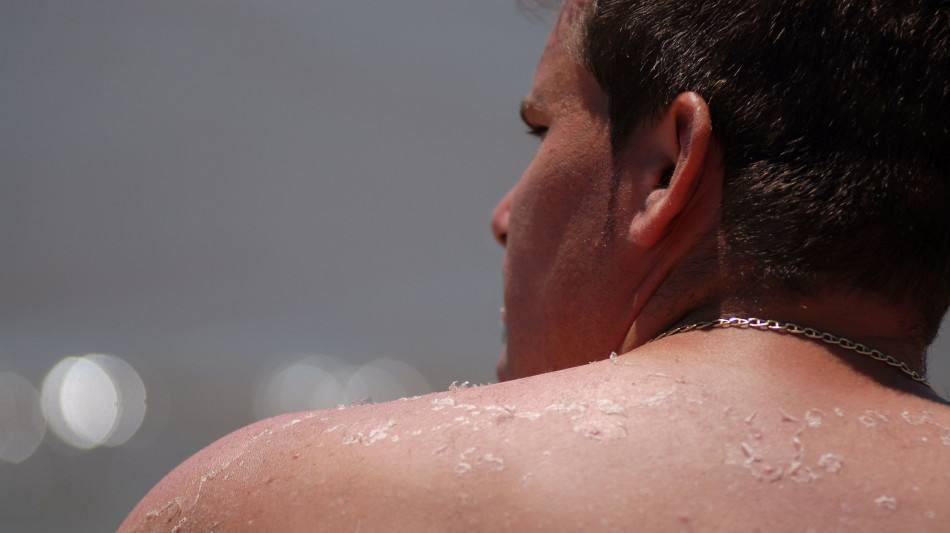 I lettini abbronzanti possono raddoppiare l'età della pelle