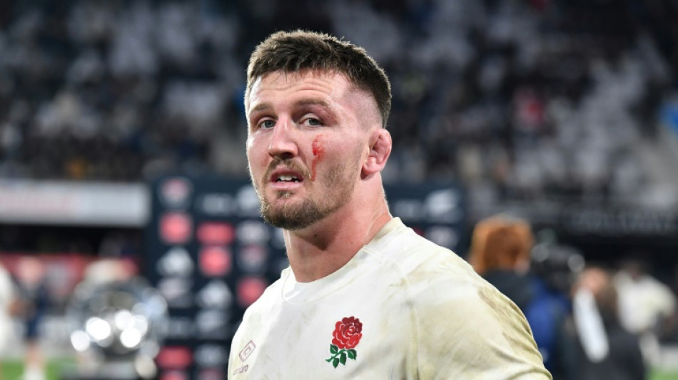 England adamant Curry 'ready to go' against Japan after concussion