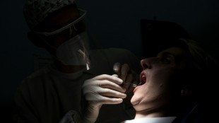 Des pays s'accordent pour interdire le mercure dans les plombages dentaires d'ici 2034