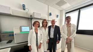Tumore all'ovaio, all'ospedale Molinette il test genetico Hrd 'in house'