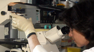 Le prime spie del Parkinson sono nelle sinapsi, studio scopre nuova funzione proteina
